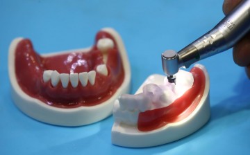 65세 이상 지르코니아 보철 임플란트도 건보 급여 받는다