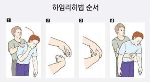 [독자기고]기도 막히는 위급상황, '하임리히 법' 꼭 기억하자